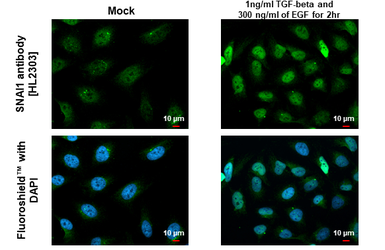 Anti-SNAI1 antibody [HL2303] used in Immunocytochemistry/ Immunofluorescence (ICC/IF). GTX638370