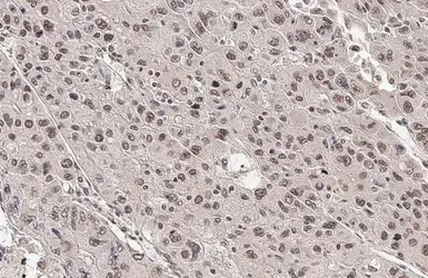 Anti-ARID1A antibody [HL2304] used in IHC (Paraffin sections) (IHC-P). GTX638371