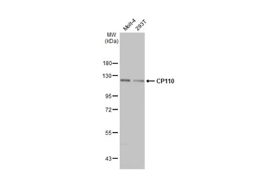 Anti-CP110 antibody [HL2312] used in Western Blot (WB). GTX638475