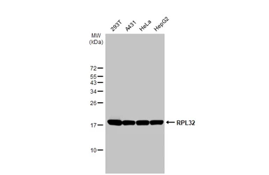 Anti-RPL32 antibody [HL2331] used in Western Blot (WB). GTX638494
