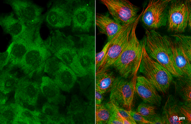 Anti-RPL32 antibody [HL2331] used in Immunocytochemistry/ Immunofluorescence (ICC/IF). GTX638494