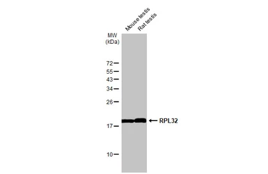Anti-RPL32 antibody [HL2331] used in Western Blot (WB). GTX638494