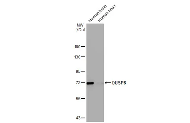 Anti-DUSP8 antibody [HL2338] used in Western Blot (WB). GTX638541