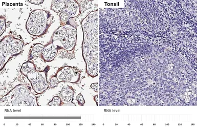 Anti-Aromatase antibody [HL2339] used in IHC (Paraffin sections) (IHC-P). GTX638542