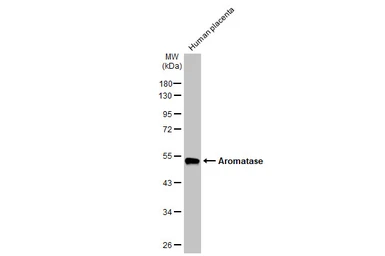 Anti-Aromatase antibody [HL2339] used in Western Blot (WB). GTX638542