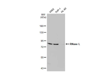 Anti-RNase L antibody [HL2340] used in Western Blot (WB). GTX638543