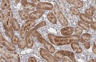 Anti-RNase L antibody [HL2340] used in IHC (Paraffin sections) (IHC-P). GTX638543