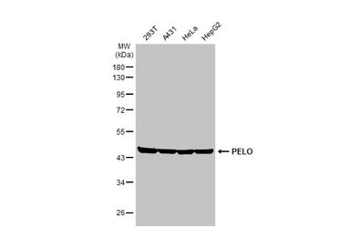 Anti-PELO antibody [HL2345] used in Western Blot (WB). GTX638548
