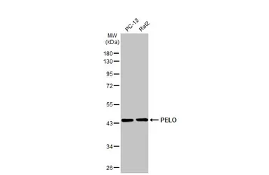 Anti-PELO antibody [HL2345] used in Western Blot (WB). GTX638548