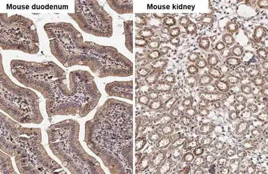 Anti-PELO antibody [HL2345] used in IHC (Paraffin sections) (IHC-P). GTX638548