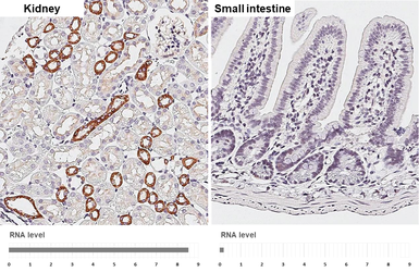 Anti-Calcium Sensing Receptor antibody [HL2357] used in IHC (Paraffin sections) (IHC-P). GTX638563
