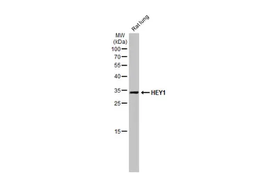 Anti-HEY1 antibody [HL2367] used in Western Blot (WB). GTX638573