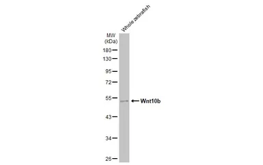 Anti-Wnt10b antibody [HL2370] used in Western Blot (WB). GTX638576