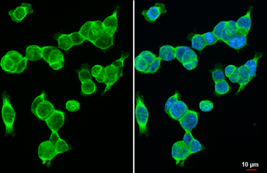 Anti-Wnt10b antibody [HL2370] used in Immunocytochemistry/ Immunofluorescence (ICC/IF). GTX638576