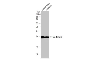 Anti-Calbindin antibody [HL2378] used in Western Blot (WB). GTX638586