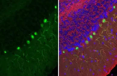 Anti-Calbindin antibody [HL2378] used in IHC (Paraffin sections) (IHC-P). GTX638586