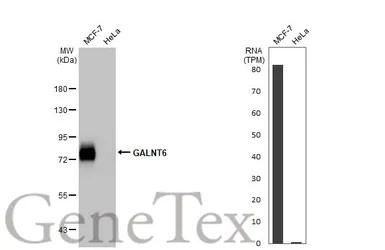 Anti-GALNT6 antibody [HL2392] used in Western Blot (WB). GTX638601