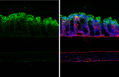 Anti-Galectin 3 antibody [HL2396] used in IHC (Frozen sections) (IHC-Fr). GTX638613
