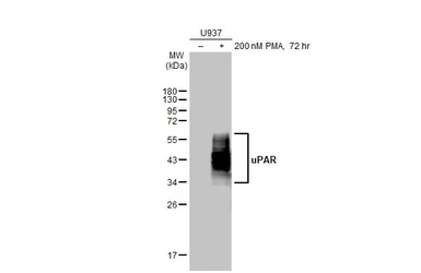 Anti-uPAR antibody [HL2398] used in Western Blot (WB). GTX638615