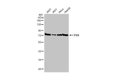 Anti-FUS antibody [HL2454] used in Western Blot (WB). GTX638772