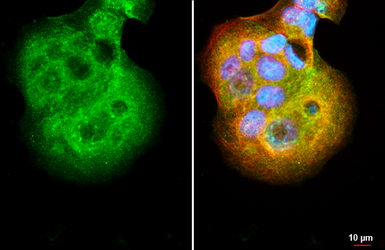 Anti-SMYD3 antibody [HL2464] used in Immunocytochemistry/ Immunofluorescence (ICC/IF). GTX638782