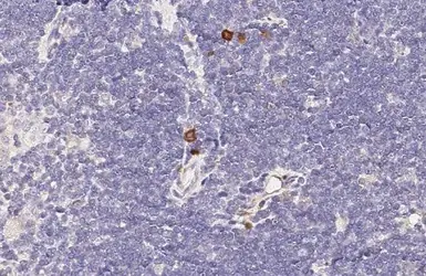 Anti-CCR4 antibody [HL2481] used in IHC (Paraffin sections) (IHC-P). GTX638830
