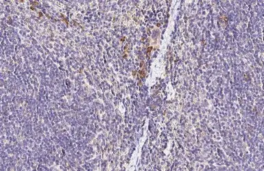 Anti-CCR4 antibody [HL2481] used in IHC (Paraffin sections) (IHC-P). GTX638830