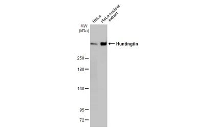 Anti-Huntingtin antibody [HL2483] used in Western Blot (WB). GTX638832