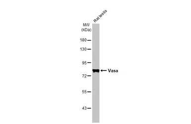 Anti-Vasa antibody [HL2485] used in Western Blot (WB). GTX638835