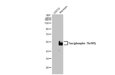 Anti-Tau (phospho Thr181) antibody [HL2497] used in Western Blot (WB). GTX638855