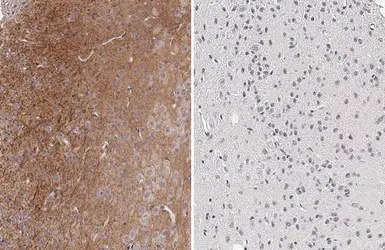 Anti-Tau (phospho Thr181) antibody [HL2497] used in IHC (Paraffin sections) (IHC-P). GTX638855