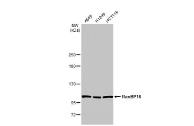 Anti-RanBP16 antibody [HL2510] used in Western Blot (WB). GTX638871
