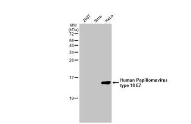 Anti-Human Papillomavirus type 18 E7 antibody [HL2522] used in Western Blot (WB). GTX638883