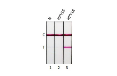 Anti-Human Papillomavirus type 18 E7 antibody [HL2522] used in Lateral Flow (Lateral Flow). GTX638883