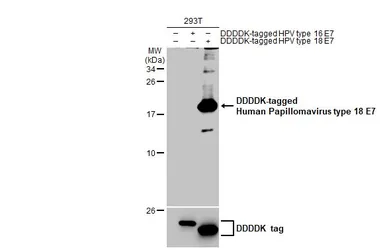 Anti-Human Papillomavirus type 18 E7 antibody [HL2522] used in Western Blot (WB). GTX638883