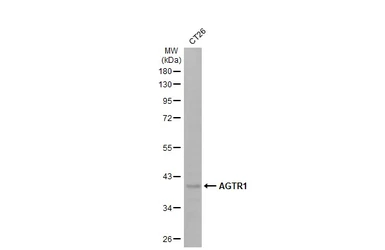 Anti-AGTR1 antibody [HL2526] used in Western Blot (WB). GTX638887