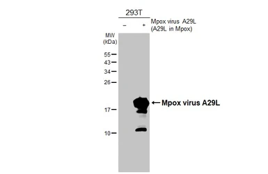 Anti-Mpox virus A29L antibody [HL2527] used in Western Blot (WB). GTX638888