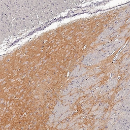 Anti-mGluR5 antibody [HL2543] used in IHC (Paraffin sections) (IHC-P). GTX638912