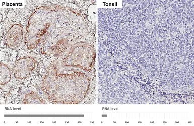 Anti-EFEMP1 antibody [HL2572] used in IHC (Paraffin sections) (IHC-P). GTX638950