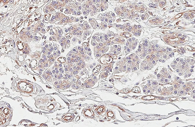 Anti-CXCR4 antibody [HL2612] used in IHC (Paraffin sections) (IHC-P). GTX639064