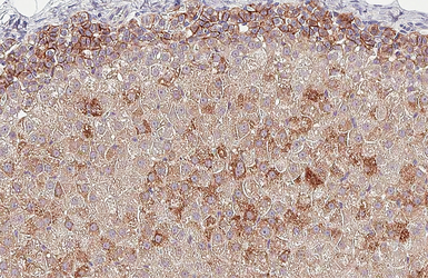 Anti-CXCR4 antibody [HL2612] used in IHC (Paraffin sections) (IHC-P). GTX639064