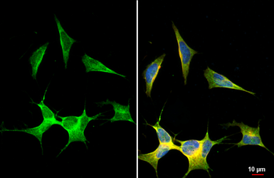Anti-ANP antibody [HL2617] used in Immunocytochemistry/ Immunofluorescence (ICC/IF). GTX639071