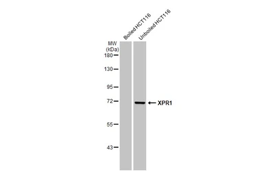 Anti-XPR1 antibody [HL2631] used in Western Blot (WB). GTX639087