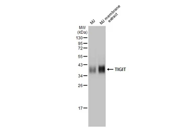 Anti-TIGIT antibody [HL2655] used in Western Blot (WB). GTX639114