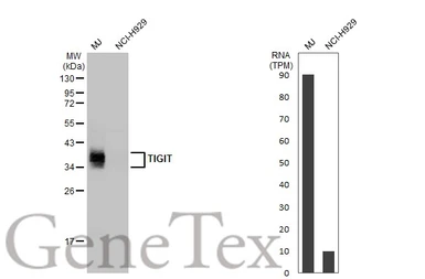 Anti-TIGIT antibody [HL2655] used in Western Blot (WB). GTX639114