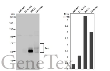 Anti-Tau antibody [HL2736] used in Western Blot (WB). GTX639564