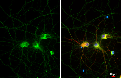 Anti-Tau antibody [HL2736] used in Immunocytochemistry/ Immunofluorescence (ICC/IF). GTX639564
