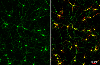 Anti-Tau antibody [HL2736] used in Immunocytochemistry/ Immunofluorescence (ICC/IF). GTX639564
