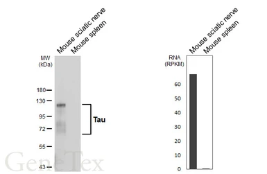 Anti-Tau antibody [HL2736] used in Western Blot (WB). GTX639564