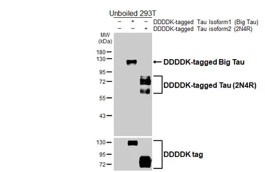 Anti-Tau antibody [HL2736] used in Western Blot (WB). GTX639564